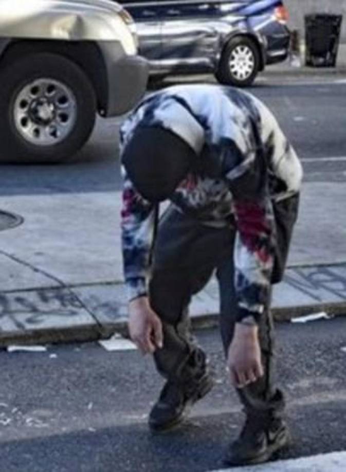 Una de las consecuencias más visibles de la xilacina, advierte la FDA, son las “heridas graves en la piel, parches de tejido muerto y en descomposición que se infectan fácilmente y, si no se tratan, pueden provocar una amputación”.