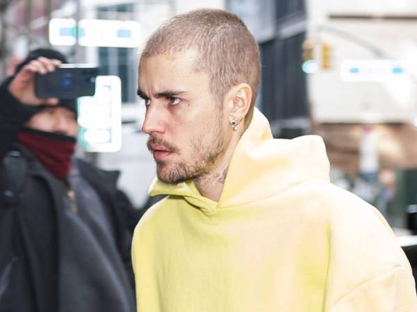 El cantante canadiense Justin Bieber ha causado preocupación por su imagen.