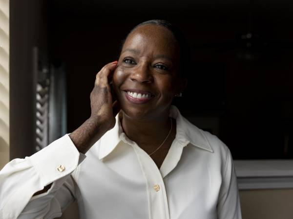 Injertos de placenta en el rostro de Marcella Townsend la hicieron lucir “exactamente como antes”, dijo.