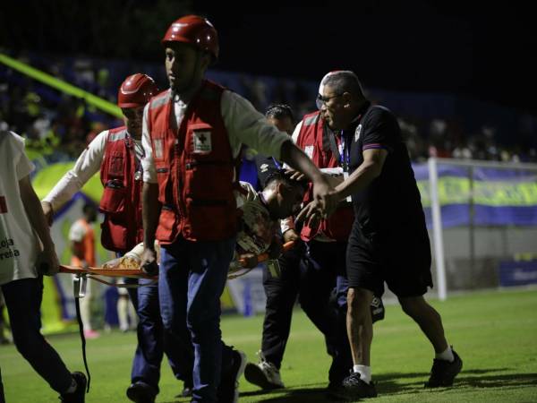 Michaell Chirinos fue traslado a un centro médico y se reporta fractura de pómulo.