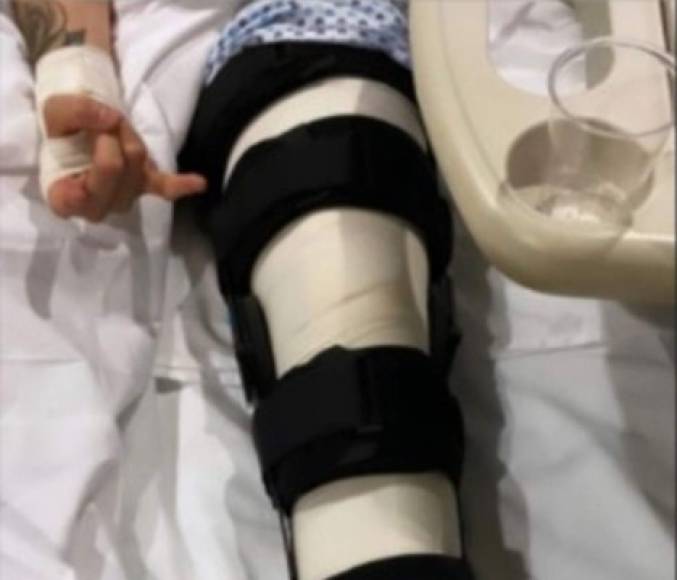 En las historias de Instagram uno de los populares hermanos publicó que debía había sufrido un aparatoso accidente en casa y que debido a ello se lesionó la rodilla.