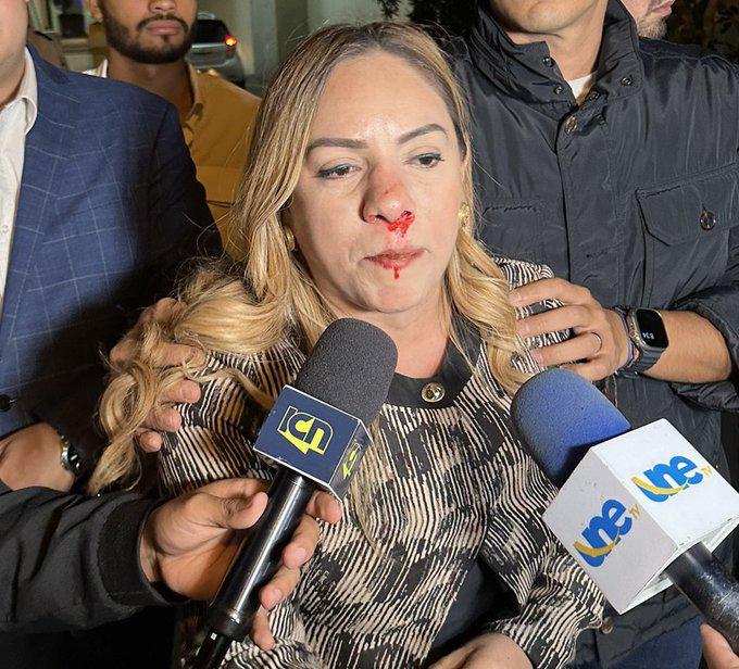 En Libre desdeñan agresión a Sara Zavala