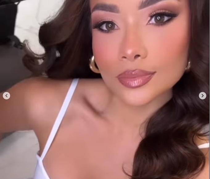 Así luce ahora Sirey Morán tras su cirugía estética y lo muestra con mucho orgullo la periodista hondureña.