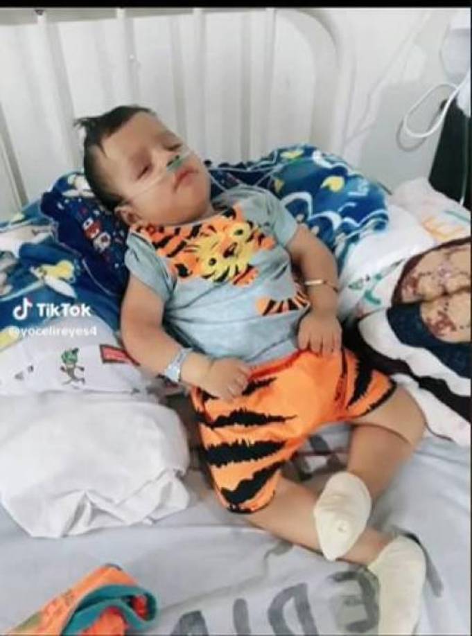 Neizan era muy conocido en las redes sociales gracias a su madre, quien usaba las plataformas digitales para solicitar ayuda y para actualizar el progreso en su salud.