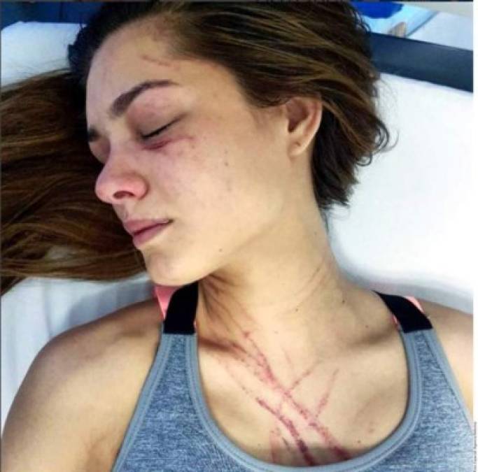 <br/>Su víctima fue la conductora de televisión Osmariel Villalobos quien se encontró con Diosa Canales en un gimnasio, discutieron, se agarraron a puños, rasguños y mordidas.