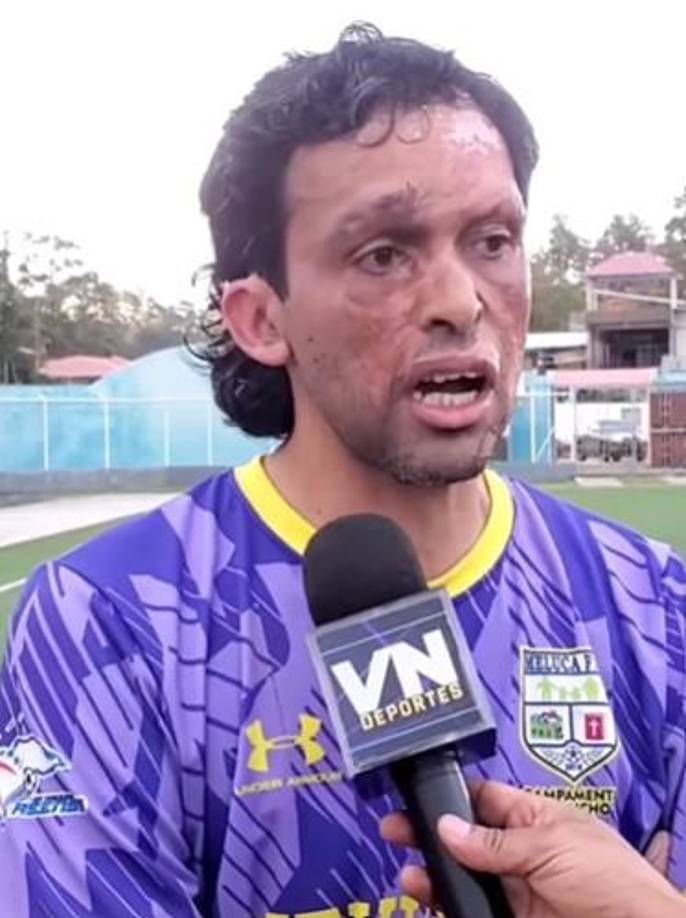 En una entrevista para VNDeportes, Amador compartió detalles sobre su faceta deportiva: “Es una faceta que nadie me la conoce, yo jugué en varios equipos y decidí venir a acá (iniciar pretemporada), tengo sangre olanchana y la idea es quedarme aquí”. 