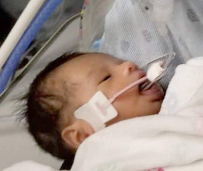 'Es muy doloroso decirlo, pero tiene muerte cerebral el niño', dijo Yiovani López, padre del bebé que permanece junto al pequeño en el hospital luego de las autoridades identificaran al pequeño con una prueba de ADN.
