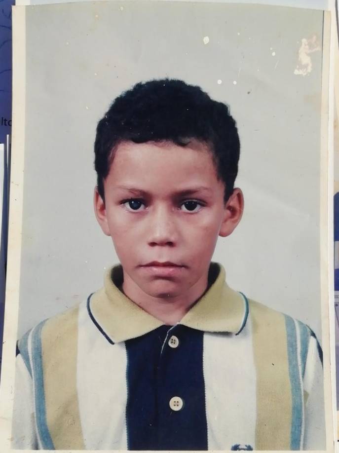 A los 9 años Ivor recibió un golpe en el ojo y desde entonces comenzó su calvario.