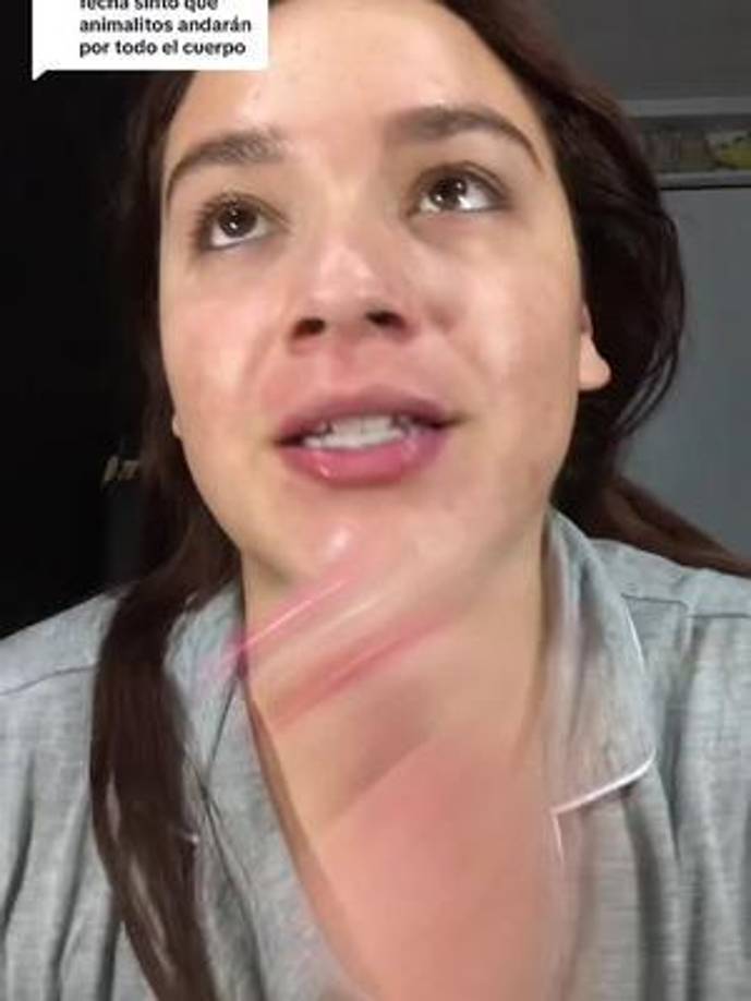 Esta historia ha sorprendido en la plataforma de videos debido a la crudeza de sus relatos y la heroica fortaleza que mostró al resistir hasta el final, luchando por mantenerse con vida.