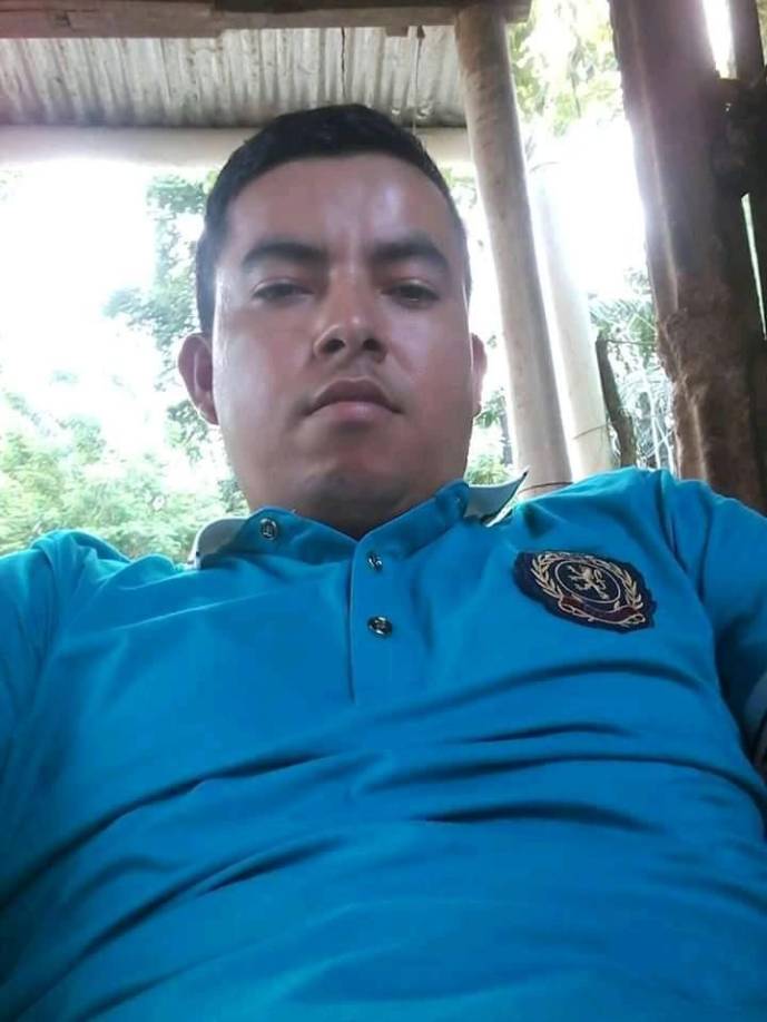 El cuerpo de Javier Antonio quedó encima de la motocicleta con su pantalón desgarrado.