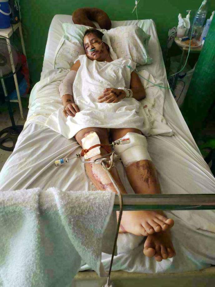 Ariel Girón había estado en una cama en su casa denunciando el ataque. 