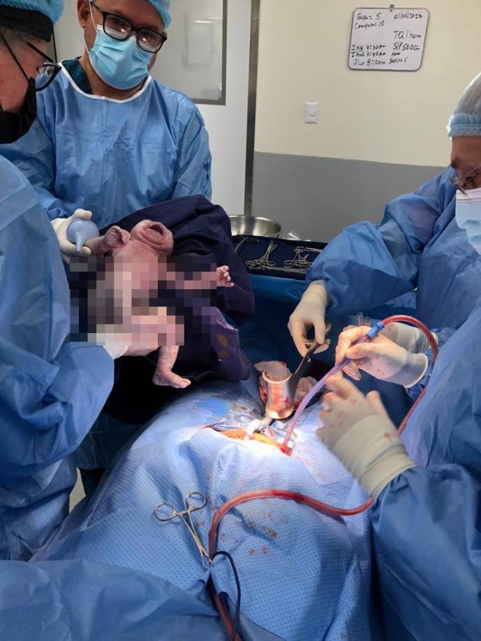 En junio del 2021 la OMS publicó su primer informe sobre inteligencia artificial en el ámbito de la salud y dos años después se marca historia con el primer embarazo y nacimiento asistido con inteligencia artificial.