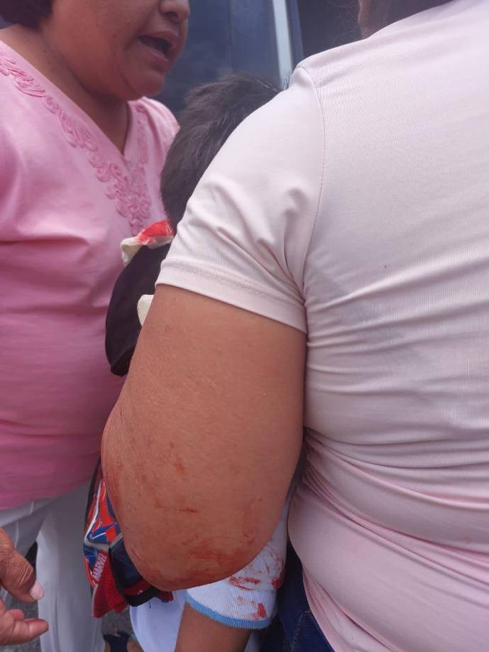 A través de su cuenta de Facebook, el alcalde ha compartido informes continuos sobre el estado de salud del pequeño desde que sufrió su accidente.