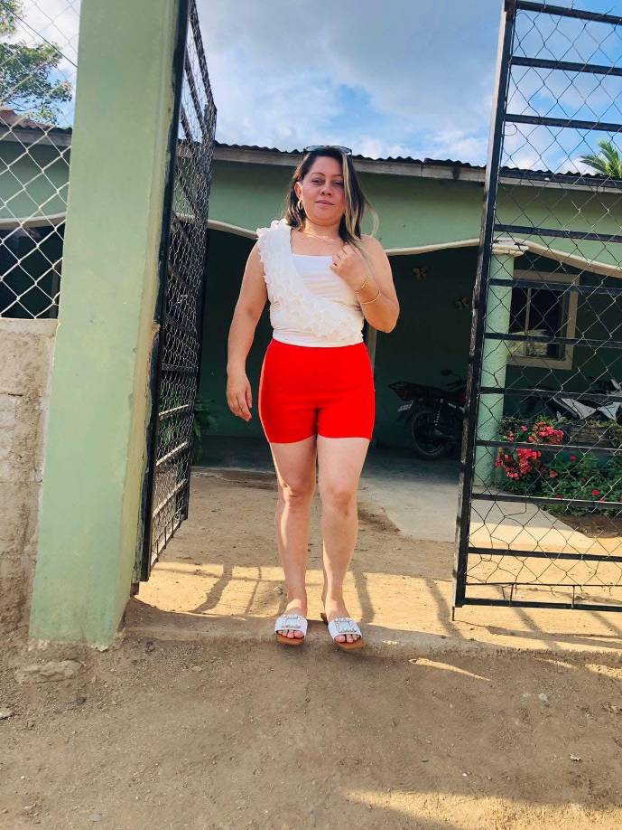 Entre lágrimas y consternación, su papá Edy Córdova dijo que su hija Francy Córdova le confesó que fue su expareja quién le disparó por celos tras ruptura desde hace dos meses.