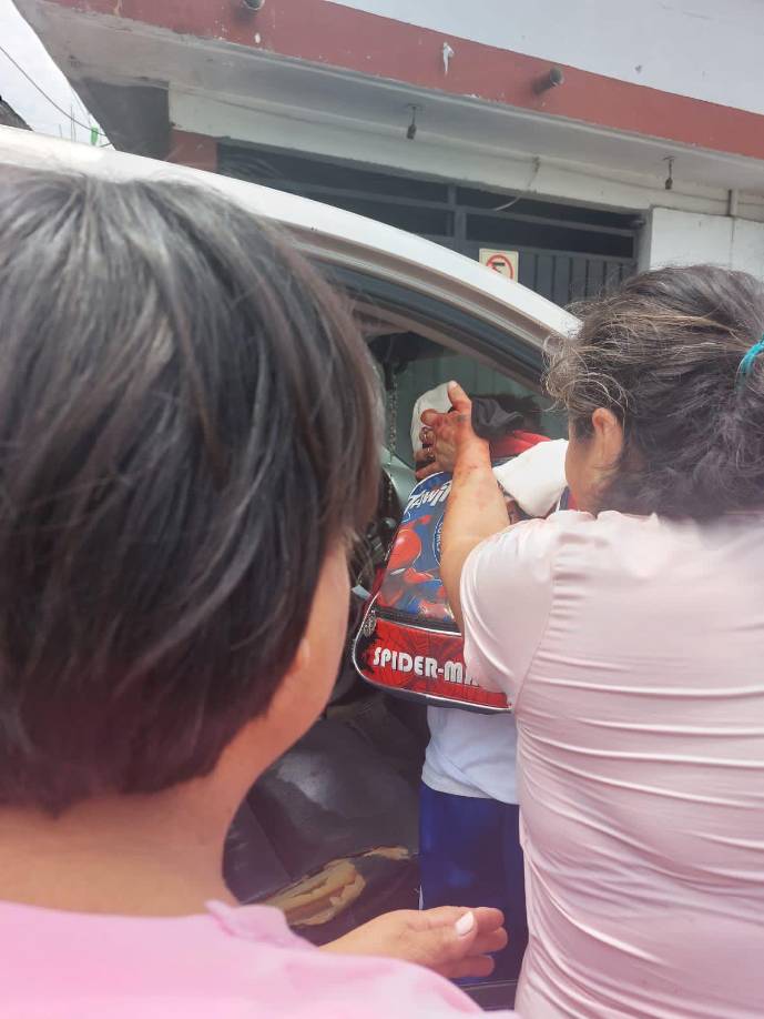 Rafael Reyes Reyes, alcalde de Jiutepec, informó que el pequeño se encuentra estable y con dieta líquida, de acuerdo con información que le fue compartida por el Instituto Mexicano del Seguro Social (IMSS) Morelos.