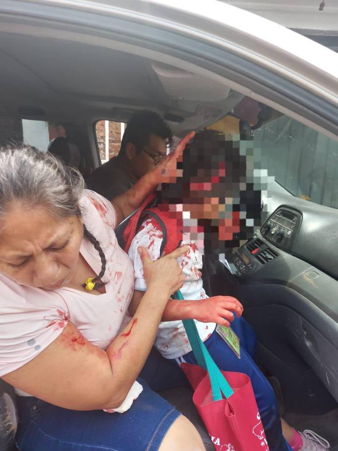 El hecho ocurrió en la colonia Otilio Montaño en Jiutepec, Morelos, México. Padres piden oraciones para la pronta recuperación del pequeño.