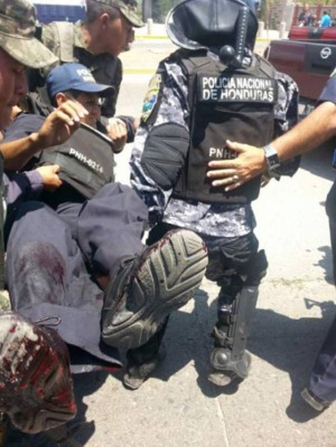 Un grupo de estudiantes que protestaba frente a los accesos de la Universidad Nacional Autónoma de Honduras (UNAH) en Tegucigalpa fueron desalojados por la Policia Nacional.