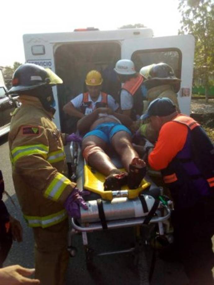 El conductor de un camión repartidor se salvó de milagro este sábado luego de accidentarse en la carretera CA-13, en el departamento de Atlántida.