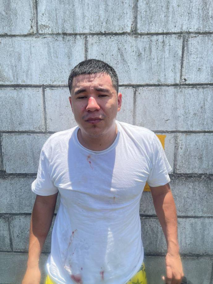 Uno de los detenidos en el operativo en el sector Felipe Zelaya. 