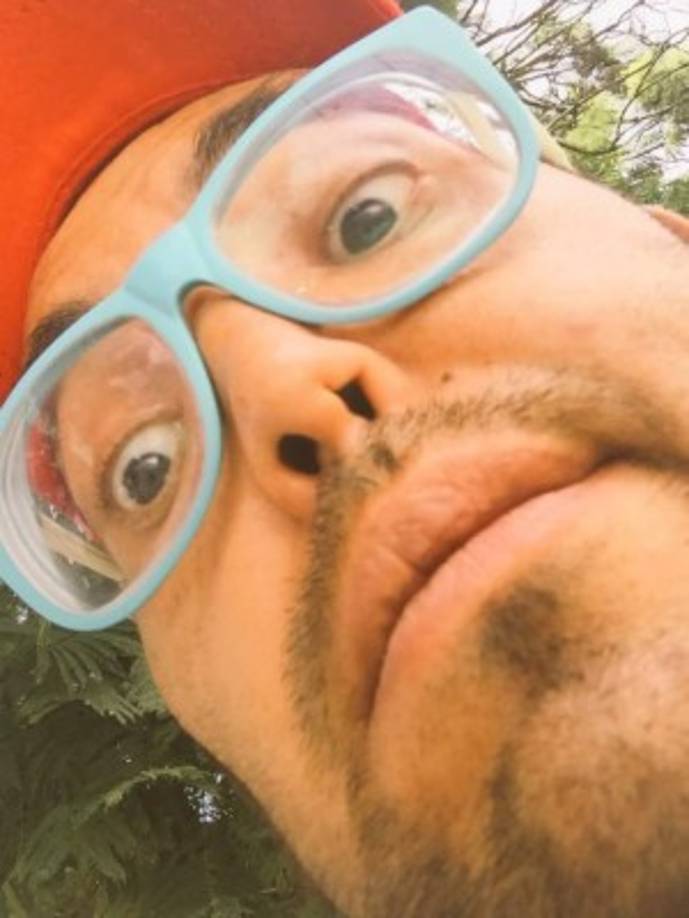 Las adicciones a la drogas deformaron la nariz de Mauricio Clark, pero hace unos meses se realizó un operación para corregirla.