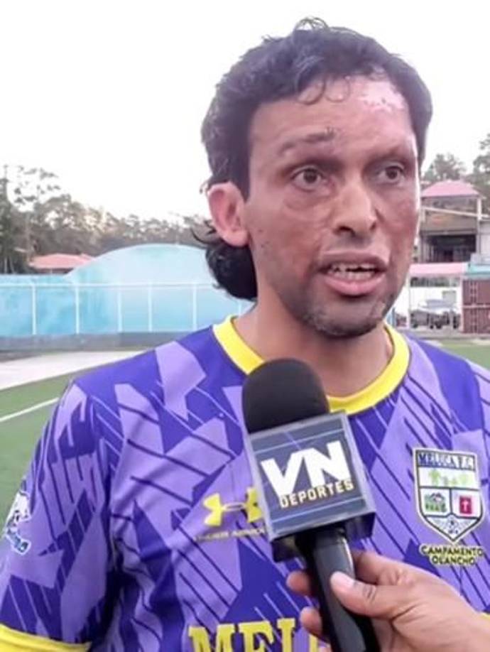 Consultado sobre cómo equilibra sus funciones como Asistente en Atención a los Presos Políticos y Sectores Sociales con su rol como futbolista, Amador aseguró que su trabajo gubernamental es supervisado “vía llamadas” y que cuenta con un equipo que lo respalda. 