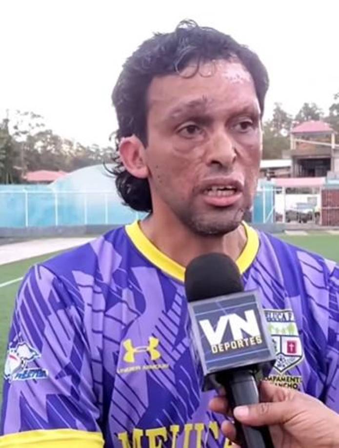 “Nosotros estamos haciendo siempre el trabajo, no importa desde qué parte, no tengo ningún problema en eso”, explicó.