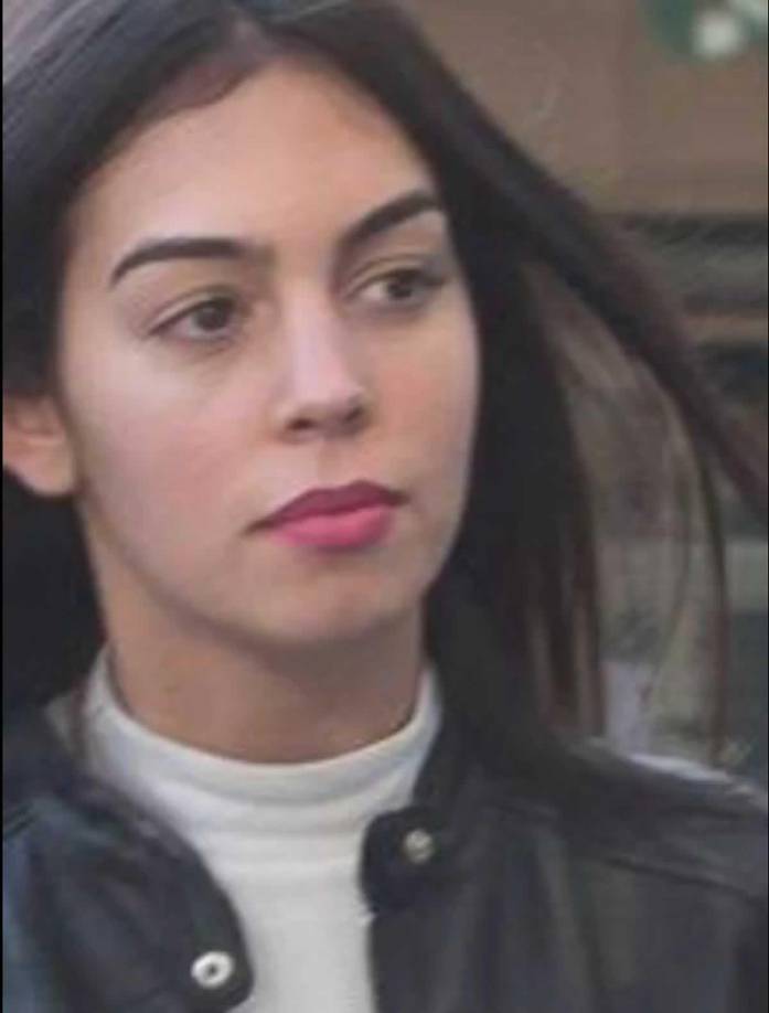 Además de su operación en la nariz, la española también se hizo una queiloplastia (operación en los labios).