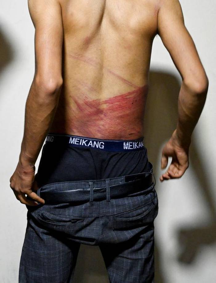 “Tras habernos golpeado, nos dijeron: ‘¿habéis entendido qué pasa cuando filmáis?’”, cuenta Nematullah. A Taqi, que preguntó por qué les golpeaban, un talibán le respondió: “Tienes suerte de que no te hayamos decapitado”.