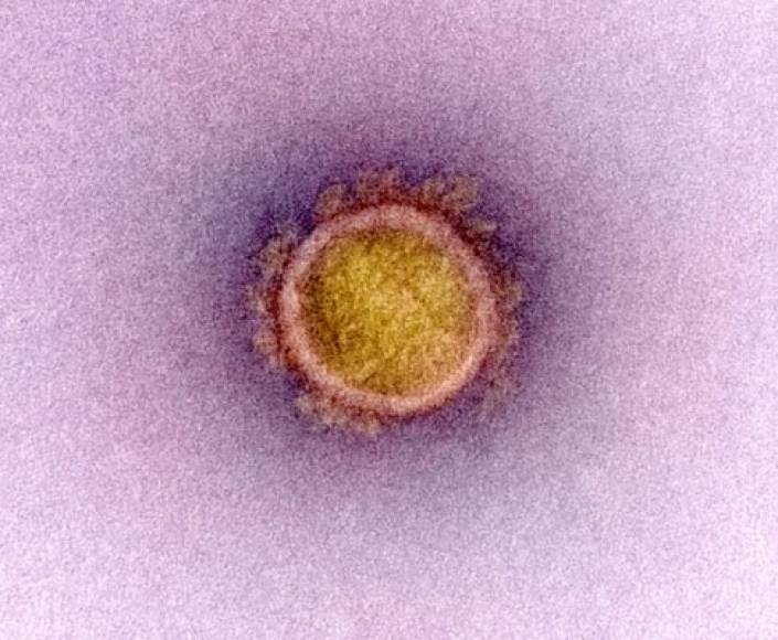 Micrografía electrónica de transmisión de una partícula de virus SARS-CoV-2, aislada de un paciente.