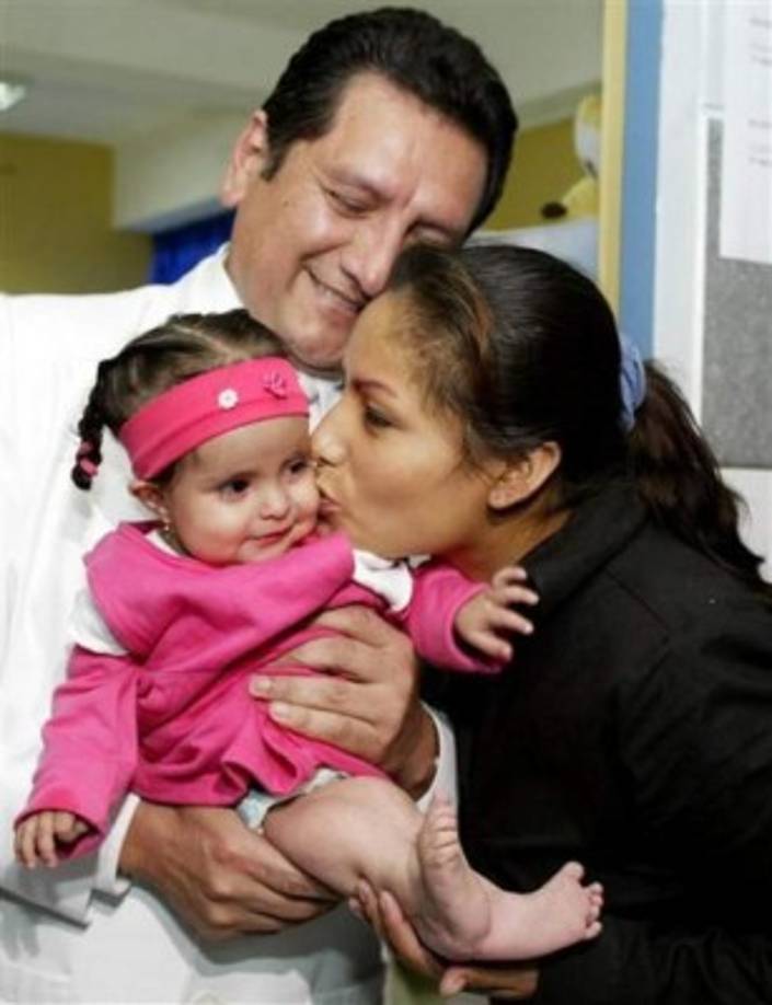 Luis Rubio, su médico tratante, afirmó que Milagros Cerrón fue el segundo caso de sirenomelia con vida extendida en el mundo. Por lo general, dijo, el paciente sobrevive apenas unos pocos días.<br/><br/>