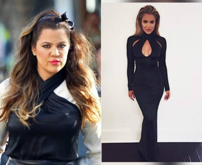 El antes y después de Khloé