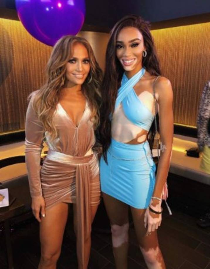 El acoso verbal la llevó a cambiar de escuela varias veces y abandonar la escuela secundaria, y hasta llegar a pensar en suicidio, por fortuna su espíritu no fue doblegado y ahora se ha convertido en una gran inspiración para otros que padecen de Vitíligio.<br/>