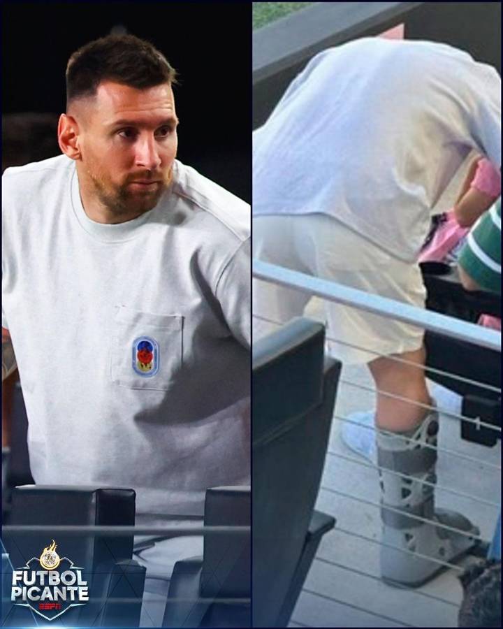 Messi estuvo en el partido del Inter Miami ante Toronto y se dejó ver con una bota protectora en el tobillo derecho.