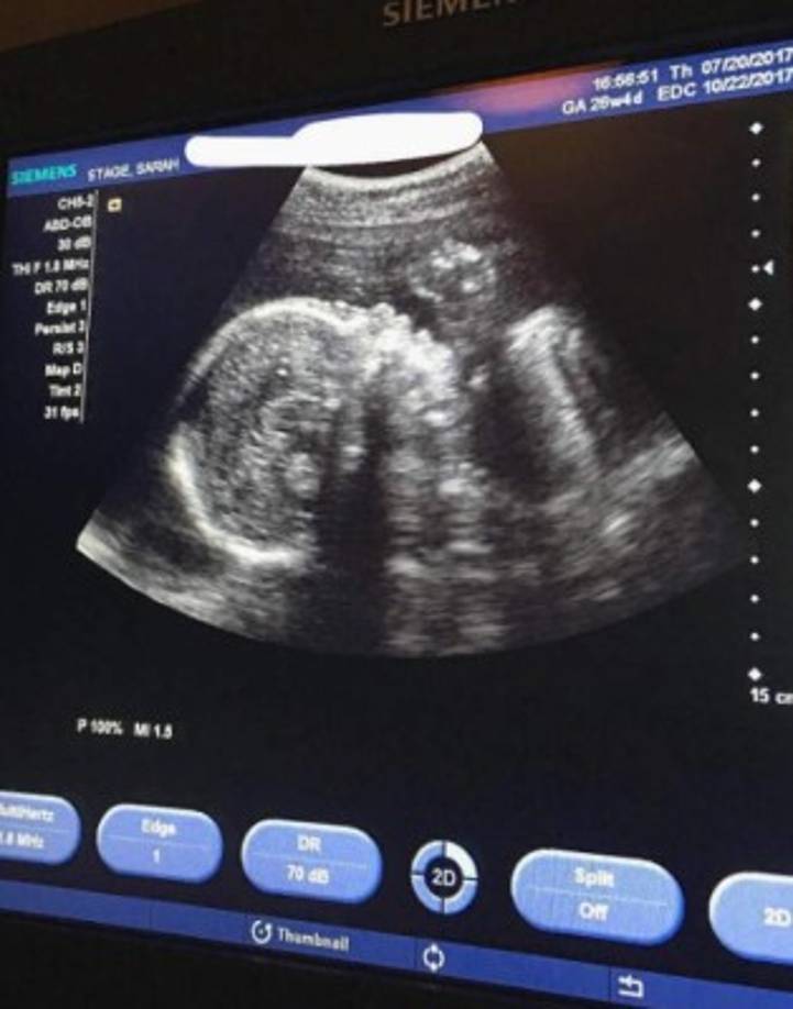 La modelo, residente en Los Angeles, afirma que el médico le ha asegurado que el desarrollo y el peso de su bebé son totalmente normales.