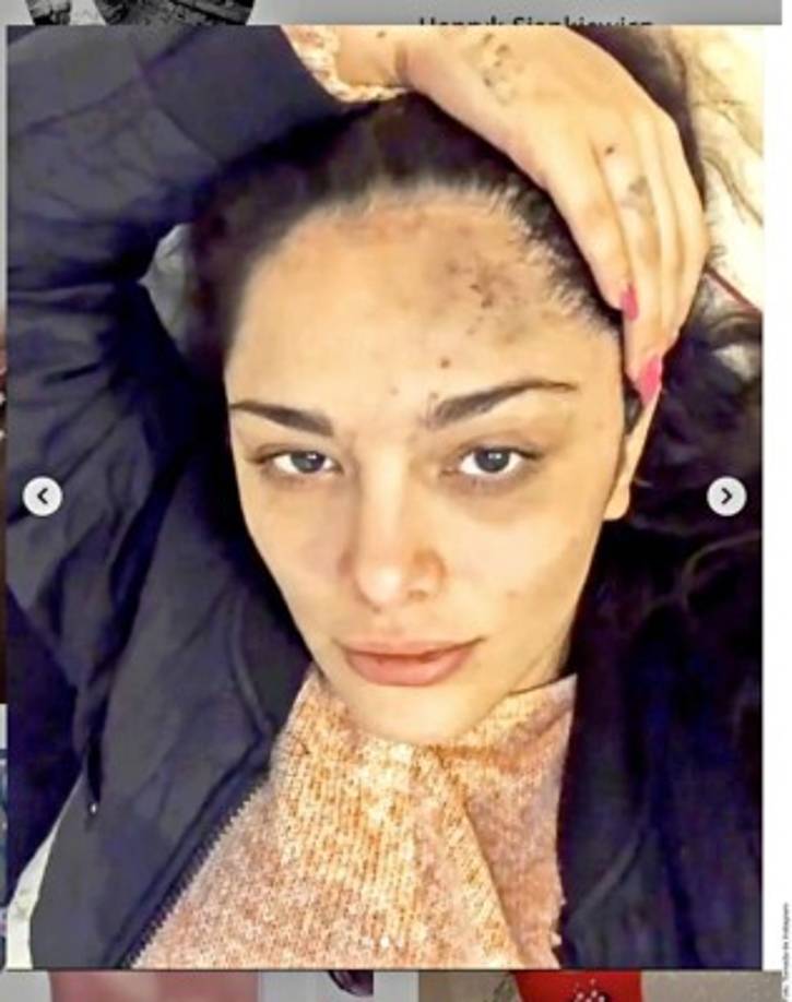 'El que se supone que es mi papá biológico y mi tía biológica, su hermana, en un intento de acercarme después de 20 años de abandono, me golpearon. Me golpearon entre todos. Por encontrar a mi papá biológico esto es lo que recibo', dijo Vanda Barbie entre lágrimas. <br/>