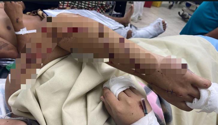 Cae sujeto que con machete atentó contra su pareja frente a posta de Barandillas