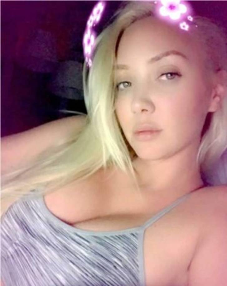 La actriz colgó esta imagen en su Instagram acompañado del siguiente mensaje: 'Gracias por sus buenos deseos chicos. Estoy bien. No es tan malo como parece. Me estoy curando rápidamente. Mucho amor a mi equipo de Camsoda por cuidar bien de míI'.