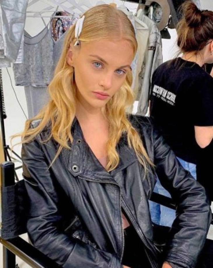 'Está consciente pero apenas puede decir nada ... debido a sus heridas en la cabeza', dijo su agente Liliya Chepigina.