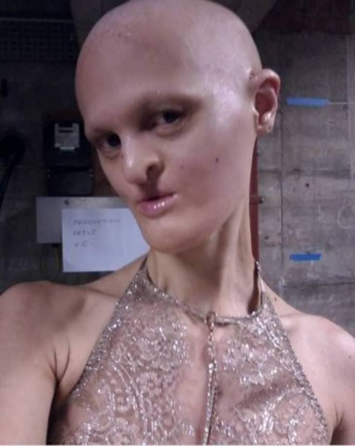 Algo que hace a Gaydos única, es que se niega a usar implantes dentales o una peluca.