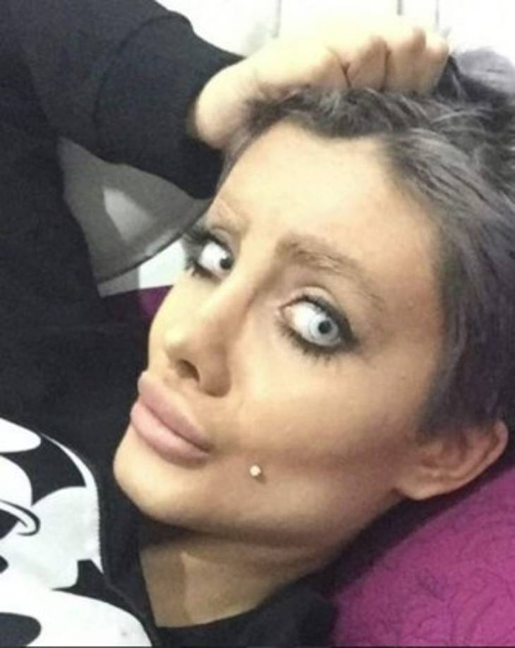 Distintos medios informaron el año pasado que Tabar se había sometido a unas 50 cirugías para parecerse a Angelina Jolie.