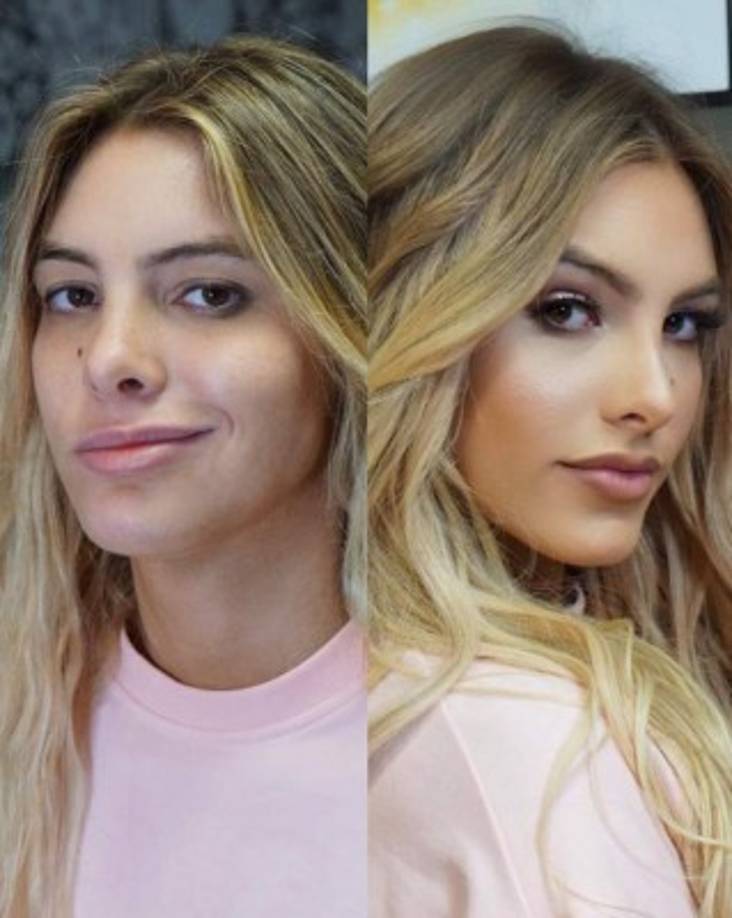 Al aceptar que se ha operado, para Lele Pons mostrarse sin maquillaje ya no le asusta.
