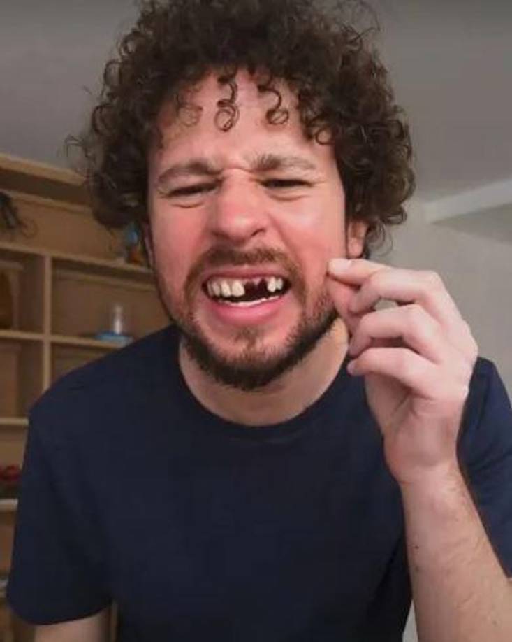 Luisito Comunica regresó a la cámara gritando, con su boca cubierta de sangre.