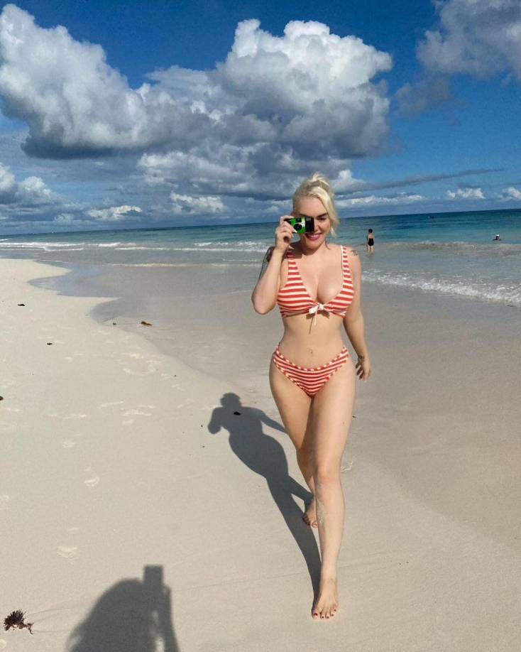 ¿Qué le pasó Jennifer? Le amputan una pierna tras vacaciones