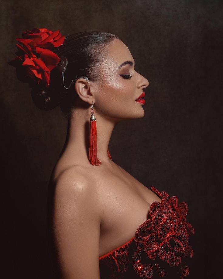 Aunque su capacidad para comunicarse verbalmente es limitada, Mia utiliza la lengua de señas para expresarse, como lo demostró en su emotivo discurso de aceptación. Este logro es posible gracias a un implante coclear que le permite percibir sonidos, facilitando su comunicación y participación en diversas actividades.