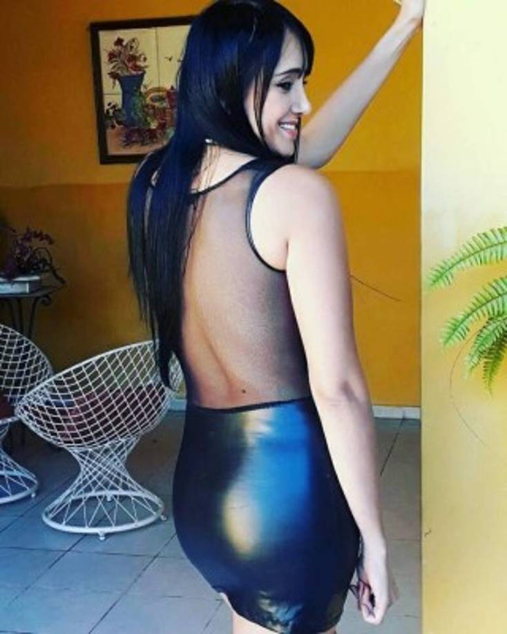 La vida de esta joven cambió radicalmente tras el accidente, pues de estar con lesiones en sus pies y sumida en una profunda depresión, ahora se luce como una flamante modelo de pasarela.