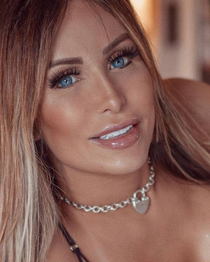 <b>Lygia sufrió un derrame cerebral</b>, causado por una mala intervención quirúrgica.