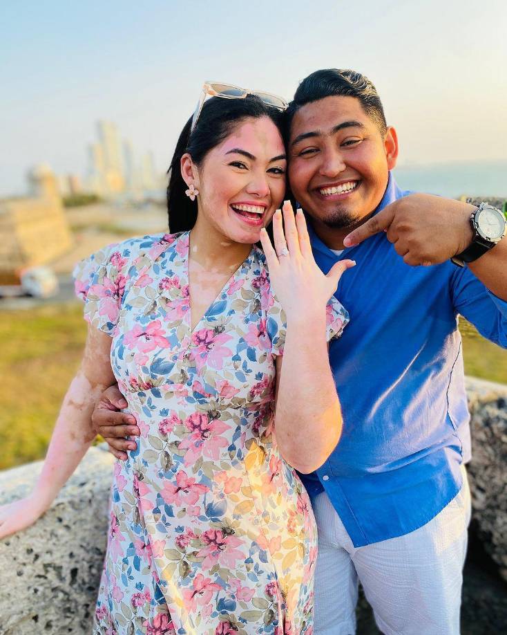 Por otro lado, a través de su Instagram, la simpática y elegante joven compartió una noticia personal positiva. El 4 de marzo del 2024 se comprometió con su pareja, después de más de cinco años de noviazgo. 