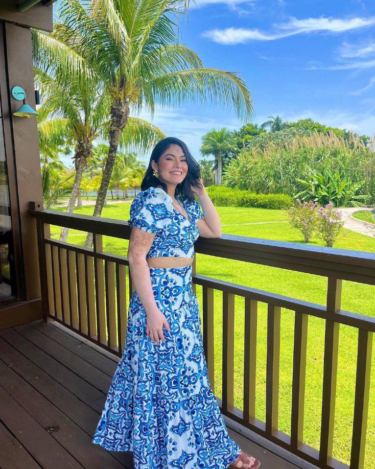 La representante de Choluteca ha luchado contra viento y marea para llegar a aspirar a una corona del Miss Honduras Universo. Las críticas y los comentarios inapropiados por el vitíligo han sido una constante en su vida, pero lo cierto es que su autodeterminación, amor propio y el cariño de sus seres queridos la fortalecen para amar su presente. 