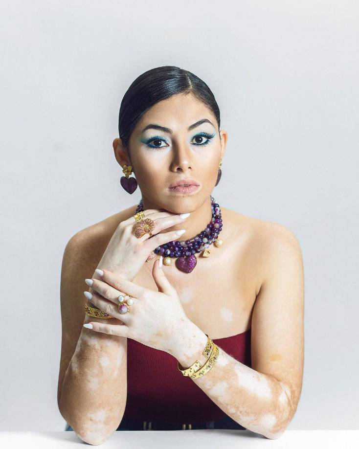 Para poder apoyar a Michelle Enamorado, lo puede hacer asistiendo al evento el jueves 22 de agosto en el Centro de Convenciones del Hotel Copantl de San Pedro Sula. Adquiera su entrada en el siguiente enlace: <a rel="nofollow" href="https://bmthonduras.pagatusboletos.com/venta/es/entradas-entradas-evento-miss-universe-honduras-2024">https://bmthonduras.pagatusboletos.com/venta/es/entradas-entradas-evento-miss-universe-honduras-2024</a>. También puede apoyarla a través de la página de Instagram: <a rel="nofollow" href="https://www.instagram.com/misshondurasuniverse/?hl=es">@misshondurasuniverse</a> o en su perfil público de la misma red social como: <a rel="nofollow" href="https://www.instagram.com/anymichelenamorado/">@anymichelenamorado</a>.