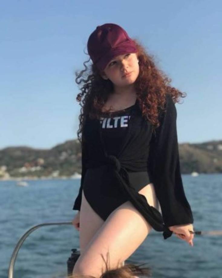 Bozzo, quien de niña participó en telenovelas como Abismo de pasión, Corazón valiente y Quiero amarte, no es la primera famosa que decide reducir sus senos.